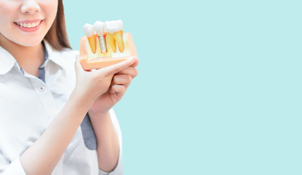 Woman holding dental example implant false tooth on pastel blue background copy space her having beautiful smile